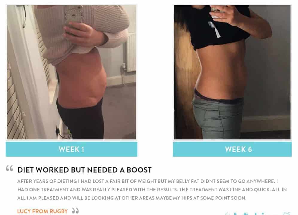 Before and After Dieting Royal Tunbridge Wells