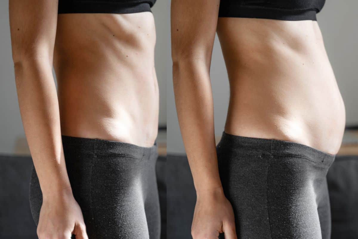 How long does diastasis recti take to improve Royal Tunbridge Wells?
