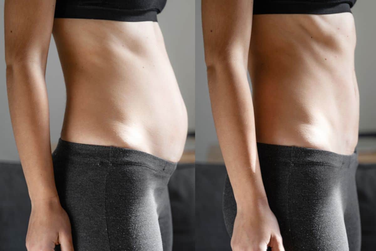 Post-Pregnancy: What Happens to Your Abdominal Muscles After Birth Royal Tunbridge Wells