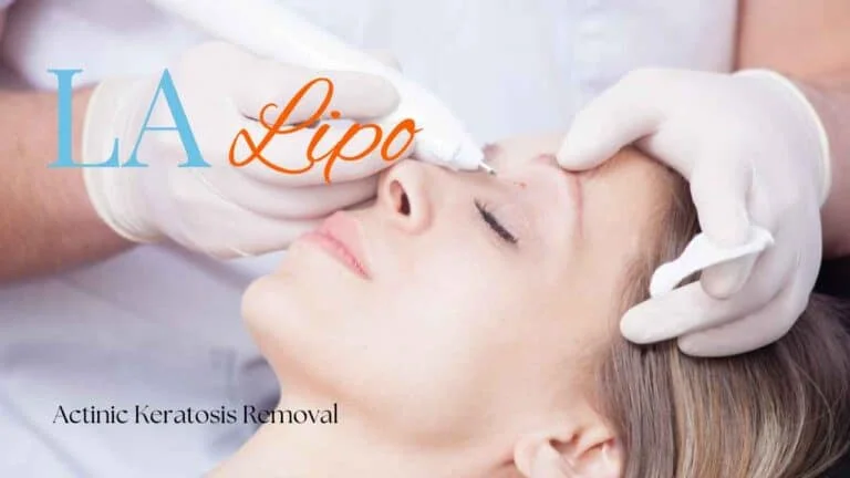 Woman receiving Actinic Keratosis Removal Treatment Royal Tunbridge Wells
