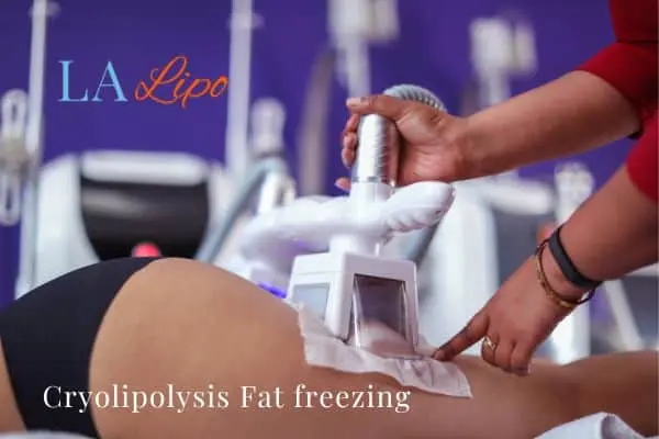 women getting fat freezing Royal Tunbridge Wells