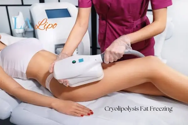 Woman receiving coolsculpting Royal Tunbridge Wells treatment on her thighs