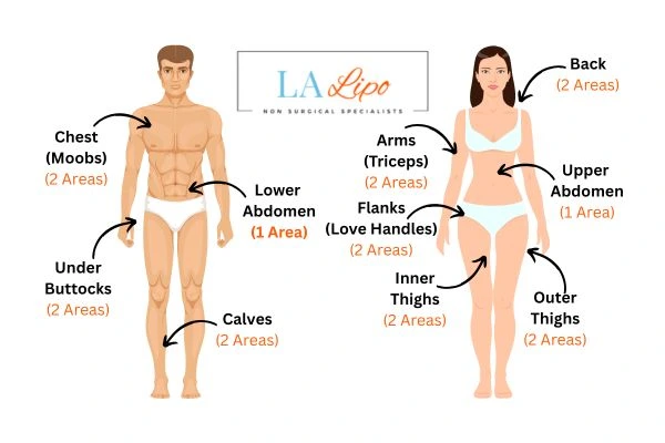 LA LIPO Cryolipolysis Areas Royal Tunbridge Wells