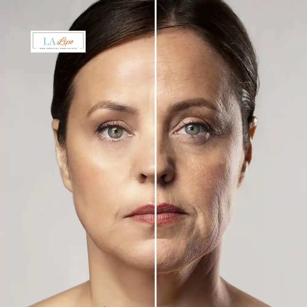 How Can You Tell If Non-Surgical Skin Tightening Is Right for You Royal Tunbridge Wells?