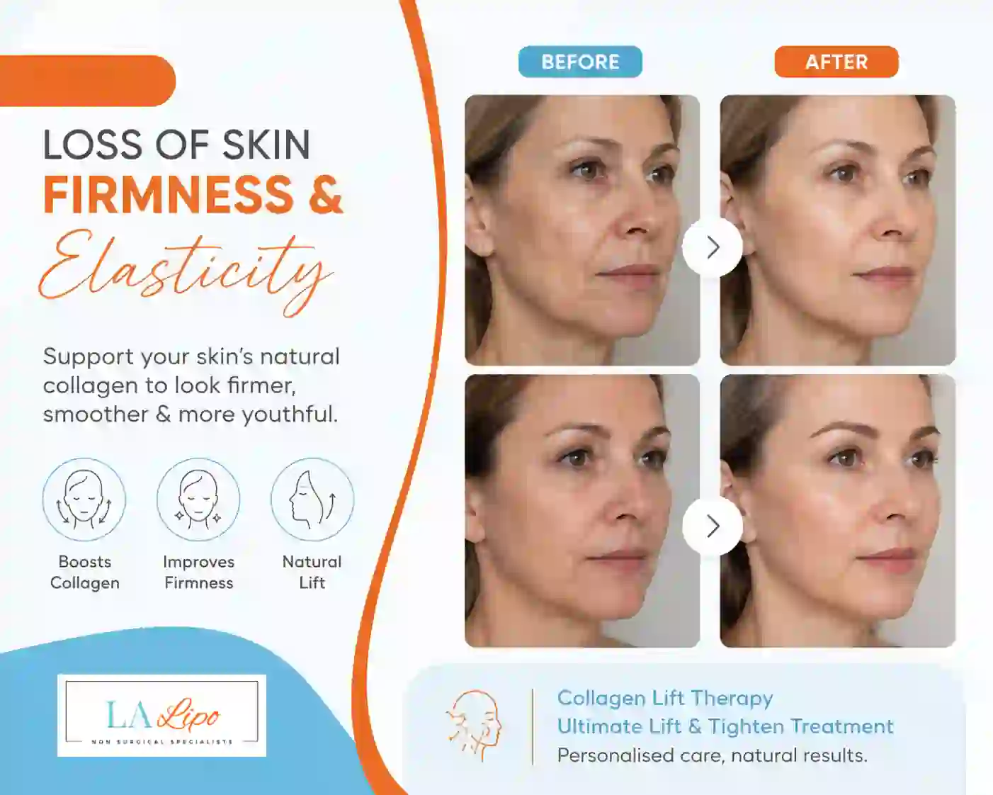 Sign #7: Loss of Skin Firmness and Elasticity Royal Tunbridge Wells