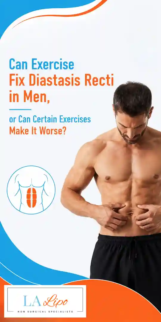 Can Exercise Fix Diastasis Recti in Men, or Can Certain Exercises Make It Worse Royal Tunbridge Wells?