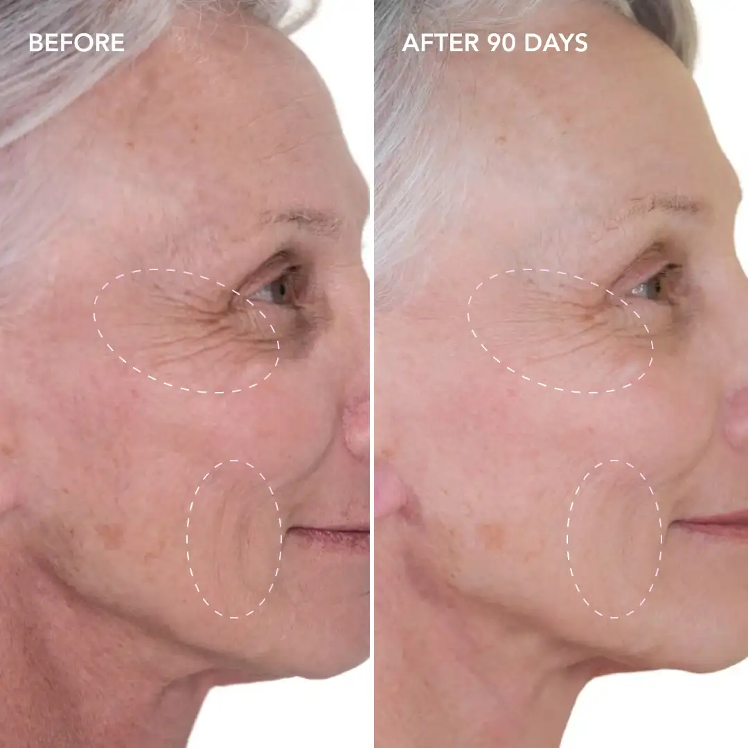 When will you see results Royal Tunbridge Wells
